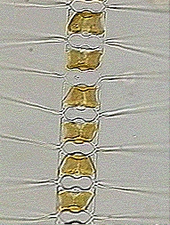Diatomeenkette