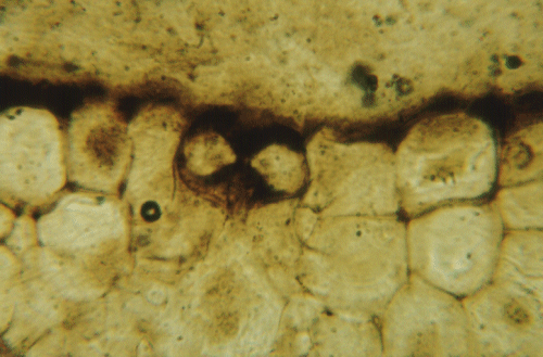 Stoma of  Rhynia